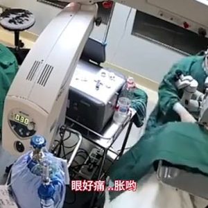 Moment Doctor Punches 82-year-old Patient in the Face Three Times While Performing Surgery on her Eyes Because She Kept Moving (Video)
